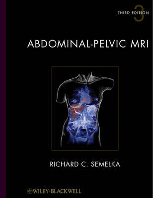 Abdominal-pelvic MRI image