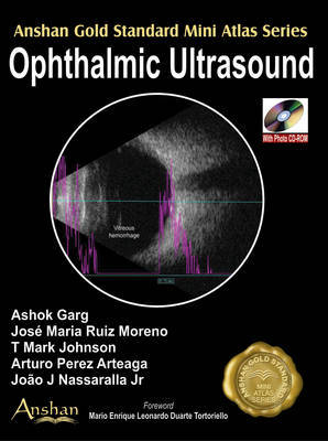 Mini Atlas of Ophthalmic Ultrasound by Ashok Garg image