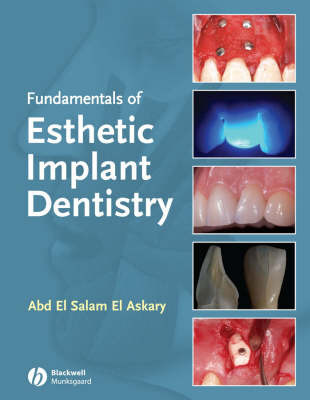 Fundamentals of Esthetic Implant Dentistry by Abd El Salam El Askary image