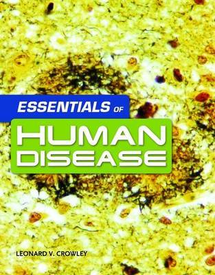 Essentials of Human Disease by Leonard V Crowley image